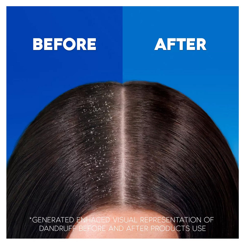 Head and Shoulders Classic Clean & Apple Anti-Dandruff Shampoo 2 x 1L